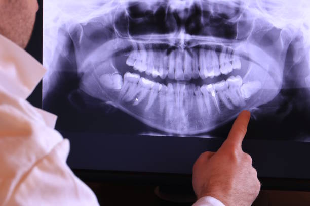 Best Urgent Care for Lost Fillings or Crowns in Belle Chasse, LA